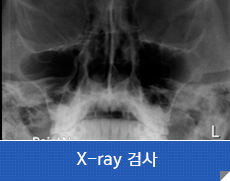 X-ray검사