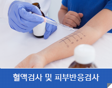 혈액검사 및 피부반응검사